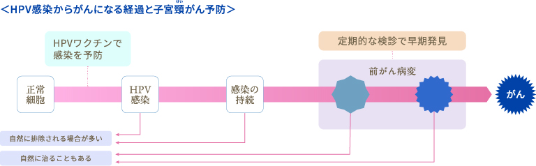 HPV感染からがんになる経過と子宮頸がん予防